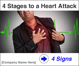 example ad GDN
